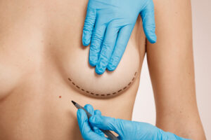 Breast surgery encompasses a variety of procedures performed on both females and males, serving a range of purposes from medical necessity to aesthetic enhancement and reconstruction.