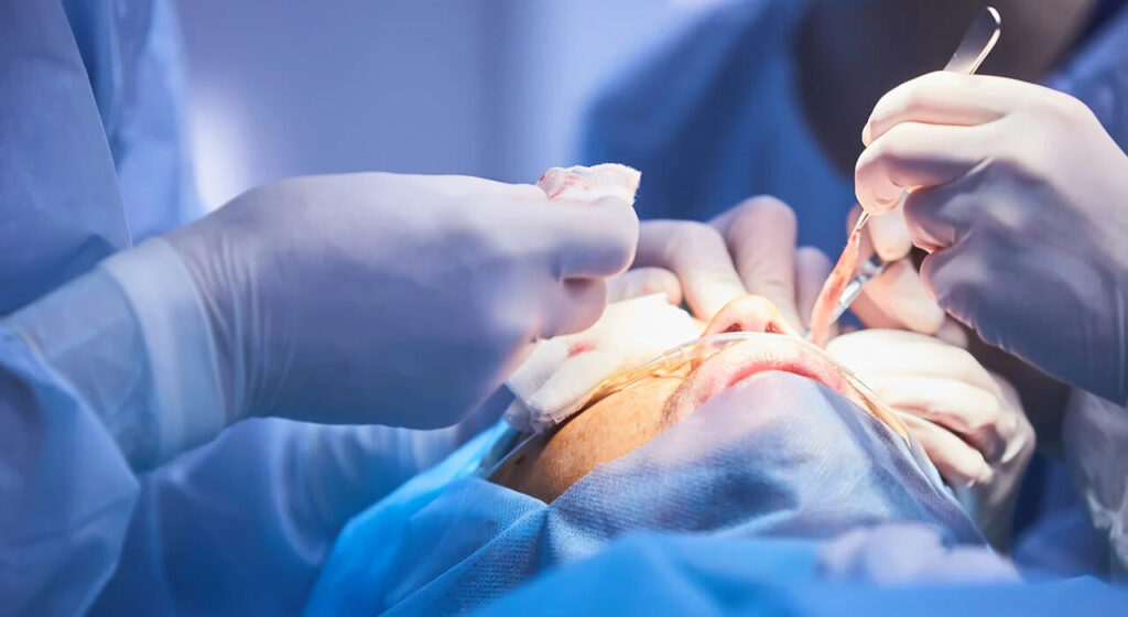 Colombia hosts highly skilled plastic surgeons with international clients benefiting from rigorous training, modern facilities, and personalized care.