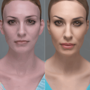 Colombia has emerged as a leading destination for Facial Feminization Surgery (FFS), with multidisciplinary teams, international patient support, and cost-effective options.